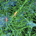 Aus Blutzellen entstehen Nervenzellen: Bonner Wissenschaftler konnten dabei das molekulare Zellalter um Jahrzehnte zurücksetzen. © Brüstle Research Group / Universität Bonn