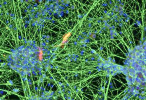 Aus Blutzellen entstehen Nervenzellen: Bonner Wissenschaftler konnten dabei das molekulare Zellalter um Jahrzehnte zurücksetzen. © Brüstle Research Group / Universität Bonn