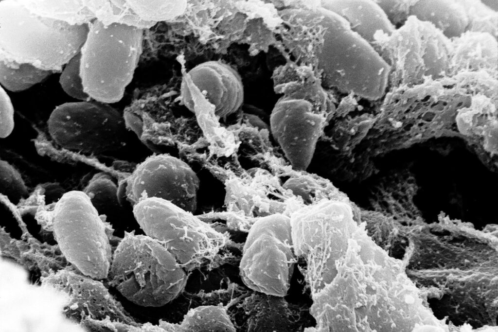 Eine Aufnahme mit dem Rasterelektronenmikroskop zeigt Pestbakterien (Yersinia pestis) im Verdauungstrakt eines Flohs. Der Erreger verursachte bereits vor 5.500 Jahren tödliche Infektionen, obwohl frühe Varianten noch nicht effizient durch Flöhe übertragen werden konnten. © Rocky Mountain Laboratories, NIAID, NIH / Wikimedia Commons, Public Domain