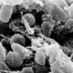 Eine Aufnahme mit dem Rasterelektronenmikroskop zeigt Pestbakterien (Yersinia pestis) im Verdauungstrakt eines Flohs. Der Erreger verursachte bereits vor 5.500 Jahren tödliche Infektionen, obwohl frühe Varianten noch nicht effizient durch Flöhe übertragen werden konnten. © Rocky Mountain Laboratories, NIAID, NIH / Wikimedia Commons, Public Domain
