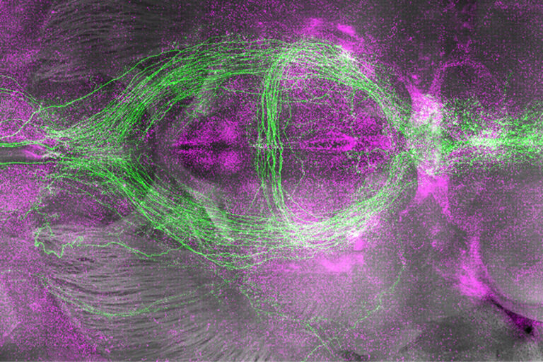 Schlaffördernde Neuronen im Mausgehirn leuchten grün, während kürzlich aktive Nervenzellen magenta erscheinen. Die Aufnahmen zeigen jene Zellgruppen, die offenbar den Schlafbedarf mitsteuern. © William Joo/ Biozentrum, Universität Basel