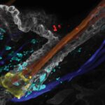 Candida auris (rot) kann sich in Haarfollikeln festsetzen und dort eine Immunreaktion (blau) auslösen, die seine Abwehr auf der Haut schwächt. © Merrill et al., Science