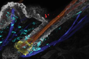 Candida auris (rot) kann sich in Haarfollikeln festsetzen und dort eine Immunreaktion (blau) auslösen, die seine Abwehr auf der Haut schwächt. © Merrill et al., Science