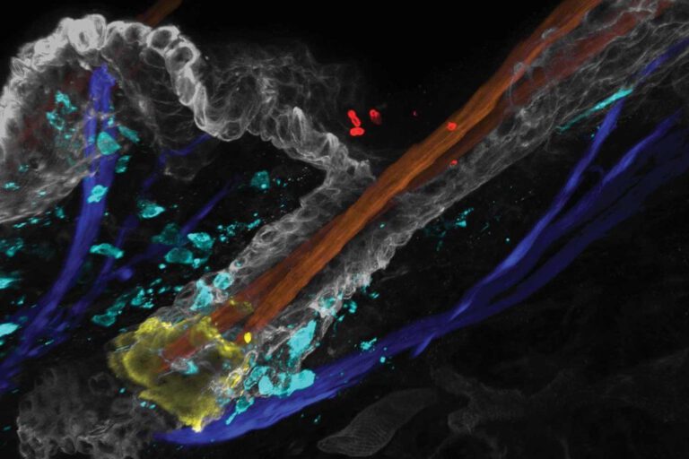 Candida auris (rot) kann sich in Haarfollikeln festsetzen und dort eine Immunreaktion (blau) auslösen, die seine Abwehr auf der Haut schwächt. © Merrill et al., Science
