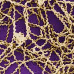 Bakterium Leptospira