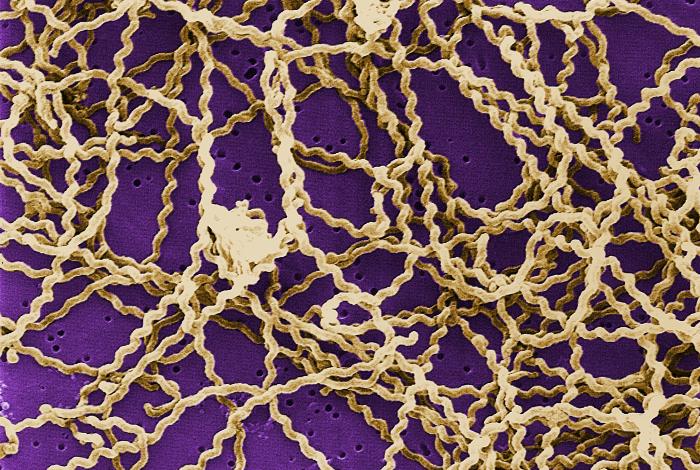 Bakterium Leptospira