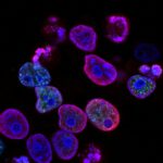 Winzige Nanopartikel könnten die Krebsbehandlung verändern: Bei Mäusen ließen sie Tumoren vollständig verschwinden und machten versteckte Krebsreste sichtbar. © Symbolbild Unsplash