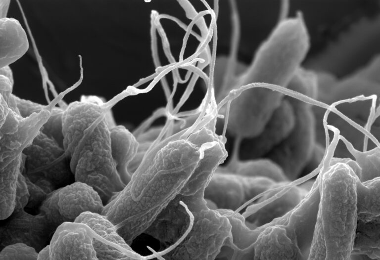 Bestimmte E.-coli-Bakterien bleiben nach der Zellteilung miteinander verbunden. Bei stärkerer Strömung können sich kleine Gruppen aus diesen Ketten lösen und weitertransportiert werden.