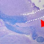 Anti-Aging-Wirkstoffe zeigen Nebenwirkungen im Gehirn: Studie weist auf Myelinverlust und gestörte Nervenzellfunktion bei Mäusen hin.