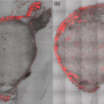 Fluoreszenzaufnahmen zeigen, wie sich der lichtempfindliche Stoff PpIX im Hauttumor von Mäusen verteilt: links nach einer ALA-Creme, rechts nach der Behandlung mit auflösbaren Mikronadeln. Rot markiert sind die Bereiche, in denen sich PpIX angereichert hat. Maßstab: 500 Mikrometer. © M. B. Requena et al., Journal of Biomedical Optics, SPIE