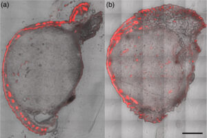 Fluoreszenzaufnahmen zeigen, wie sich der lichtempfindliche Stoff PpIX im Hauttumor von Mäusen verteilt: links nach einer ALA-Creme, rechts nach der Behandlung mit auflösbaren Mikronadeln. Rot markiert sind die Bereiche, in denen sich PpIX angereichert hat. Maßstab: 500 Mikrometer. © M. B. Requena et al., Journal of Biomedical Optics, SPIE