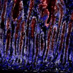 Magenschleimhaut nach Infektion mit H. pylori. Was als Reparaturreaktion beginnt, wird zum Dauerzustand – die Voraussetzung für Krebsvorstufen. Weiß dargestellt: aktiver Signalweg, der das Schleimhautgewebe in einen stark wachsenden Zustand versetzt. © Charité / Michael Sigal