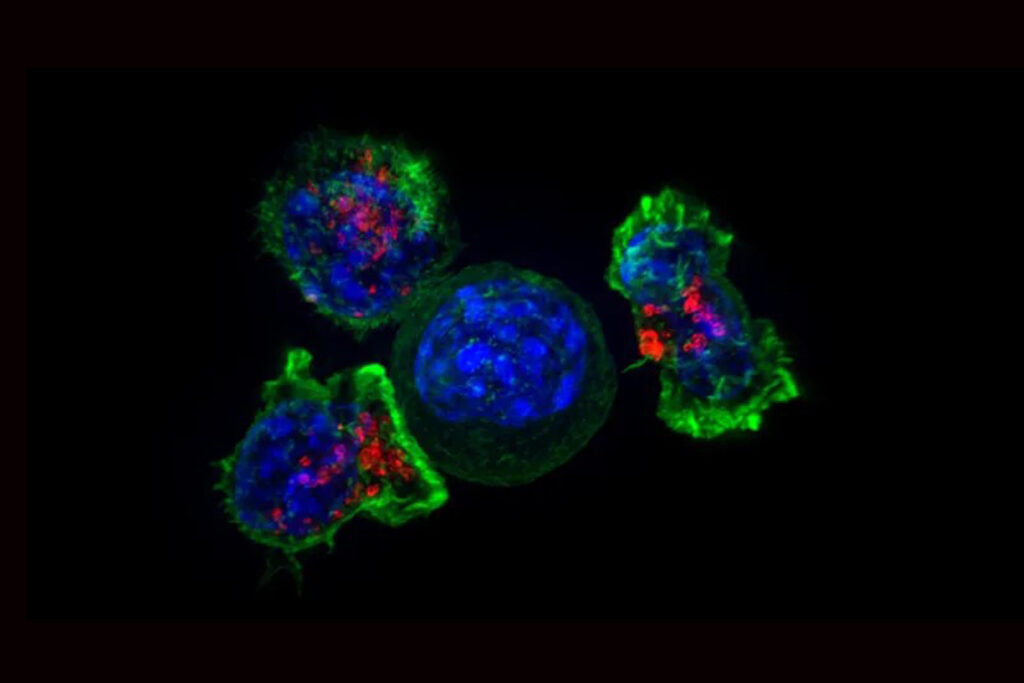 Killer-T-Zellen umringen eine Krebszelle. Tumoren können ihren Angriff jedoch bremsen, indem sie antioxidative Enzyme freisetzen und den Immunzellen wichtige Sauerstoffsignale entziehen. © The National Institutes of Health via Wikimedia unter public domain