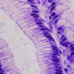 Unter dem Mikroskop ist Helicobacter pylori zu sehen