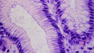 Unter dem Mikroskop ist Helicobacter pylori zu sehen
