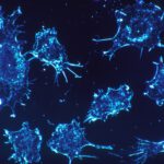 Unter anhaltendem mechanischem Druck können Krebszellen ihre Beweglichkeit verlieren und schließlich absterben. Manche Tumorzellen entkommen diesem Schutzmechanismus und können sich weiter im Körper ausbreiten.