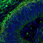 Das Bild zeigt ein im Labor gezüchtetes Mini-Gehirn, das Hinweise darauf liefert, wie sich Alzheimer früher erkennen lässt. Grün markierte Nervenzellen und blau dargestellte Zellkerne machen die Struktur des Organoids sichtbar (Maßstab: 50 Mikrometer). © Machairaki lab