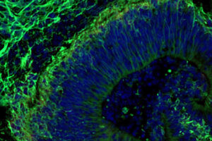 Das Bild zeigt ein im Labor gezüchtetes Mini-Gehirn, das Hinweise darauf liefert, wie sich Alzheimer früher erkennen lässt. Grün markierte Nervenzellen und blau dargestellte Zellkerne machen die Struktur des Organoids sichtbar (Maßstab: 50 Mikrometer). © Machairaki lab