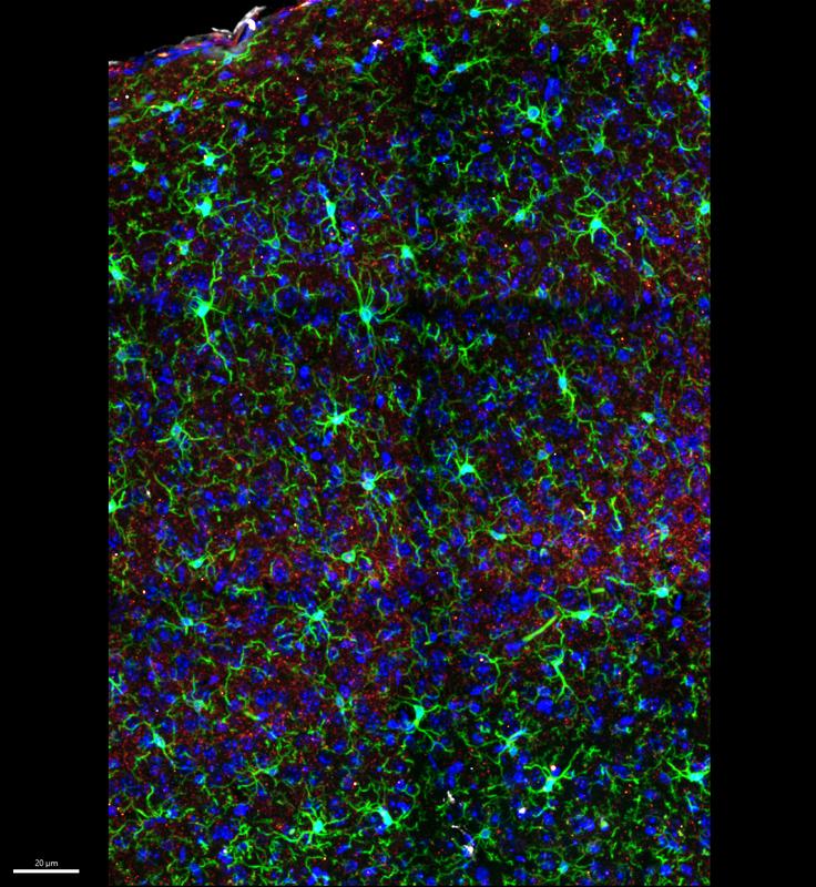 Grün leuchten die Mikroglia zwischen den orange markierten Schichten des visuellen Kortex – jene Immunzellen, die nach der Ketamin-Narkose enger an Nervenzellen rückten. © Siegert Group/ISTA
