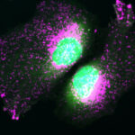 Das Mikroskopbild zeigt Zellen ohne das Protein TBC1D9B. Dadurch geraten die Lysosomen aus ihrer Ordnung, was den Zellstress erhöhen kann. © Klaudia Kosieradzka, FMP, Berlin