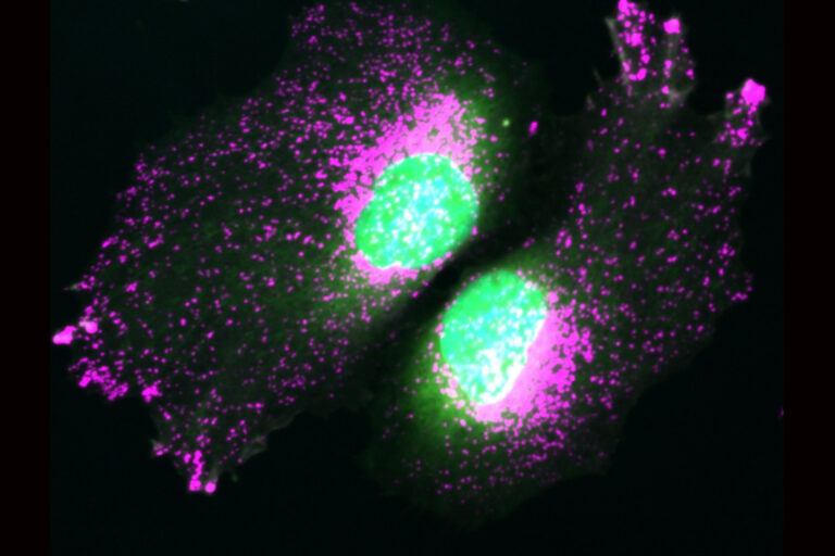 Das Mikroskopbild zeigt Zellen ohne das Protein TBC1D9B. Dadurch geraten die Lysosomen aus ihrer Ordnung, was den Zellstress erhöhen kann. © Klaudia Kosieradzka, FMP, Berlin