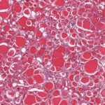 Unter dem Mikroskop wird Alterung sichtbar: Dieser Schnitt von Schilddrüsengewebe zeigt die feine Architektur, aus der KI biologische Alterungssignale herauslesen kann. © GTEx Portal (GTEX-1128S-0126)