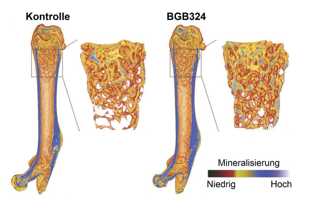 Mikro-Computertomografie-Aufnahmen zeigen eine höhere Knochendichte bei Mäusen, die mit dem Wirkstoff BGB324 behandelt wurden. © Bone Research, CC BY 4.0