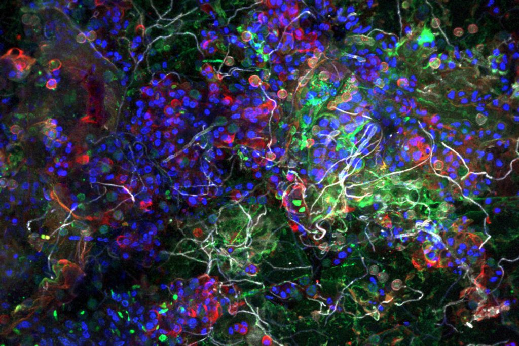 Diese Aufnahme zeigt, wie Plastikmüll im Ozean zum Lebensraum wird: Auf einem Partikel aus dem Pazifik bildet die Plastisphäre dichte Gemeinschaften aus Bakterien (grün), Algen (blau), Zuckermatrix (rot) und Pilzen (weiß). © Dr. Thomas Neu/UFZ