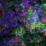 Diese Aufnahme zeigt, wie Plastikmüll im Ozean zum Lebensraum wird: Auf einem Partikel aus dem Pazifik bildet die Plastisphäre dichte Gemeinschaften aus Bakterien (grün), Algen (blau), Zuckermatrix (rot) und Pilzen (weiß). © Dr. Thomas Neu/UFZ