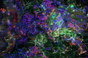 Diese Aufnahme zeigt, wie Plastikmüll im Ozean zum Lebensraum wird: Auf einem Partikel aus dem Pazifik bildet die Plastisphäre dichte Gemeinschaften aus Bakterien (grün), Algen (blau), Zuckermatrix (rot) und Pilzen (weiß). © Dr. Thomas Neu/UFZ