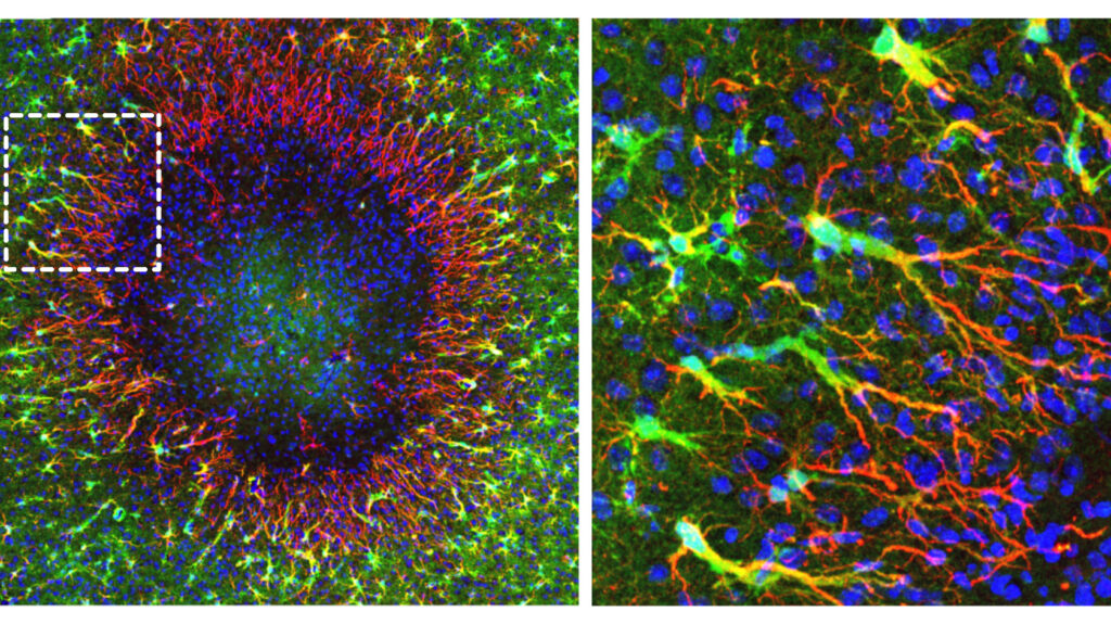 Regenerative Astrozyten beginnen am Rand einer knapp 0,5 Millimeter großen Hirnverletzung mit der Reparatur. Über lange Zellfortsätze wandern neu gebildete Zellkerne in das geschädigte Gebiet. © Institut für Pharmakologie und Toxikologie, UZH