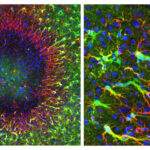Regenerative Astrozyten beginnen am Rand einer knapp 0,5 Millimeter großen Hirnverletzung mit der Reparatur. Über lange Zellfortsätze wandern neu gebildete Zellkerne in das geschädigte Gebiet. © Institut für Pharmakologie und Toxikologie, UZH