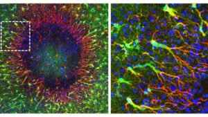Regenerative Astrozyten beginnen am Rand einer knapp 0,5 Millimeter großen Hirnverletzung mit der Reparatur. Über lange Zellfortsätze wandern neu gebildete Zellkerne in das geschädigte Gebiet. © Institut für Pharmakologie und Toxikologie, UZH