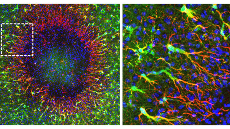 Regenerative Astrozyten beginnen am Rand einer knapp 0,5 Millimeter großen Hirnverletzung mit der Reparatur. Über lange Zellfortsätze wandern neu gebildete Zellkerne in das geschädigte Gebiet. © Institut für Pharmakologie und Toxikologie, UZH