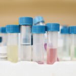 Ein Urintest könnte Blasenkrebs künftig deutlich einfacher erfassen: Statt nach Tumor-DNA sucht uRARE-seq nach RNA-Spuren, die zusätzlich etwas über das Verhalten des Tumors verraten.