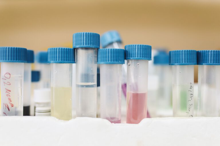 Ein Urintest könnte Blasenkrebs künftig deutlich einfacher erfassen: Statt nach Tumor-DNA sucht uRARE-seq nach RNA-Spuren, die zusätzlich etwas über das Verhalten des Tumors verraten.
