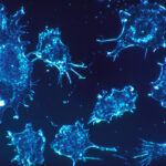 Krebszellen unter dem Mikroskop