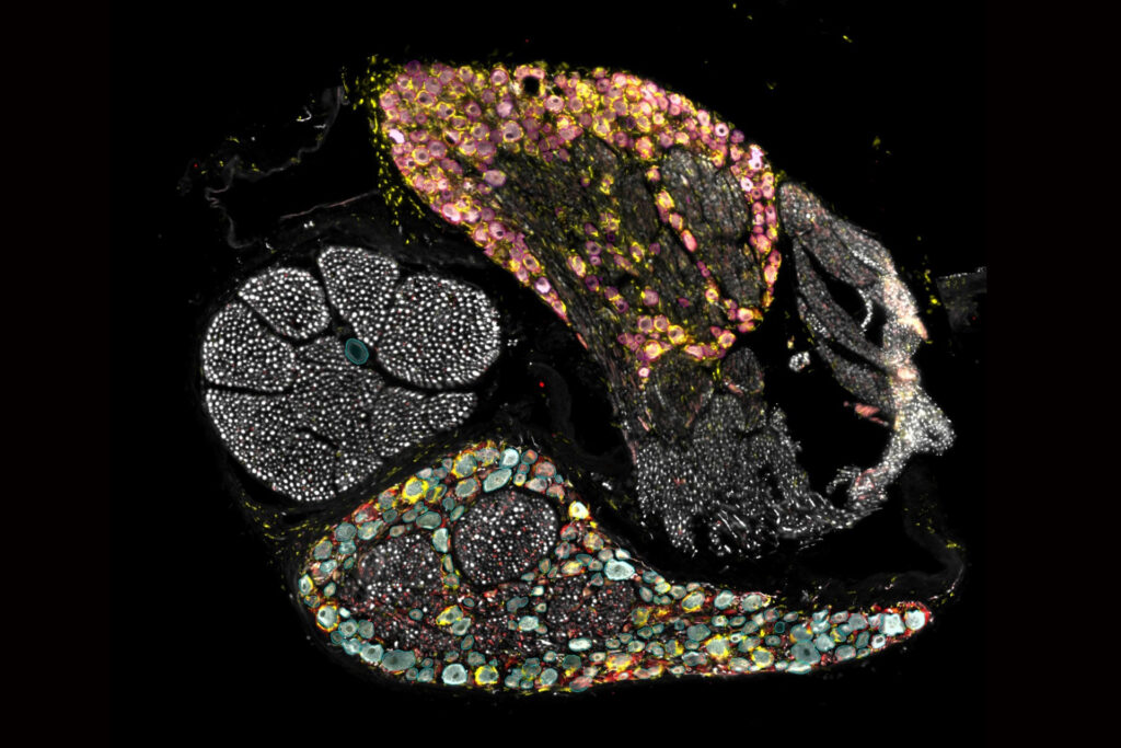 Ein Blick in den Schaltknoten des Schmerzes: Die Gewebeschnitte aus Hinterwurzelganglien machen sichtbar, wie unterschiedlich Zellen dort angeordnet sind – Neuronen grau, Makrophagen gelb, reaktive Satelliten-Gliazellen rot; Neuronen männlicher Tiere sind cyan, die weiblicher Tiere magenta segmentiert.